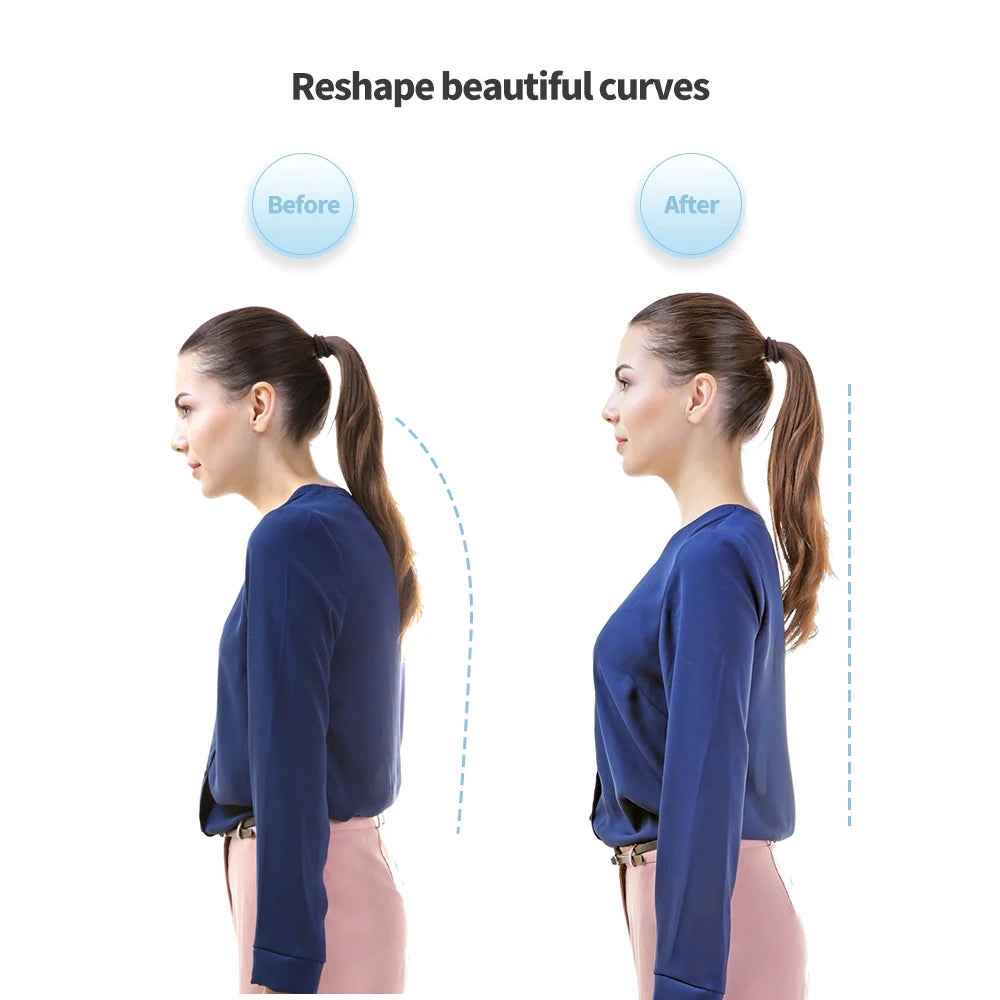 Before and after posture improvement with the Postuven Smart Posture Trainer